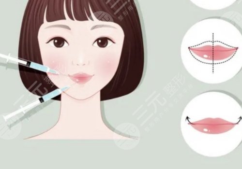 成都玻尿酸丰唇价格多少?