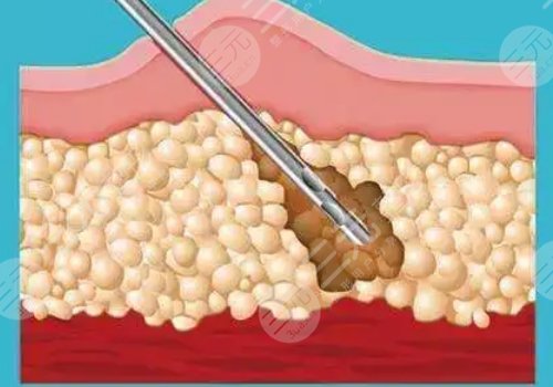 福州名韩医疗美容怎么样?