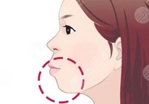 重庆松山医院做正颌手术好吗？