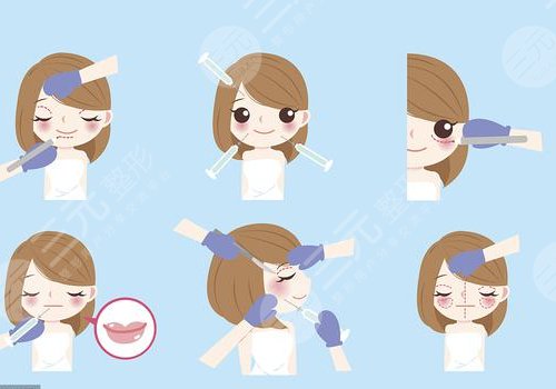 西安画美医疗美容医院注射玻尿酸怎么样?