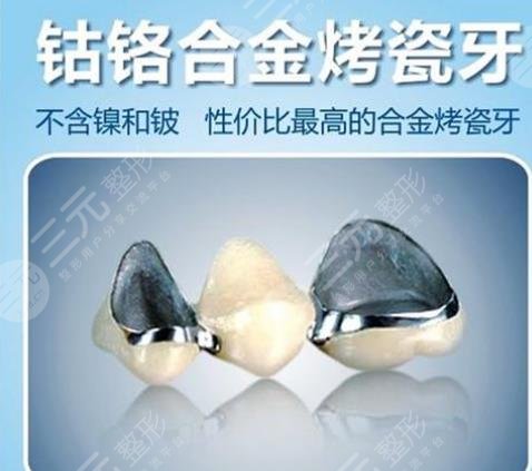 全瓷冠