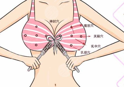 郑州美莱医疗美容医院隆胸怎么样?