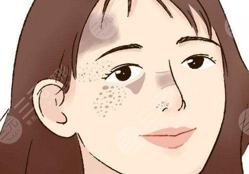 郑州集美整形祛斑效果怎么样?
