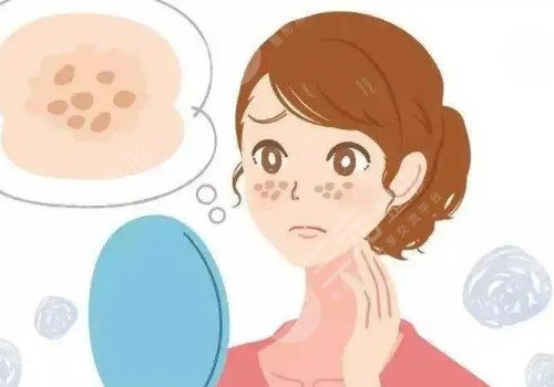 郑州集美整形祛斑效果怎么样?