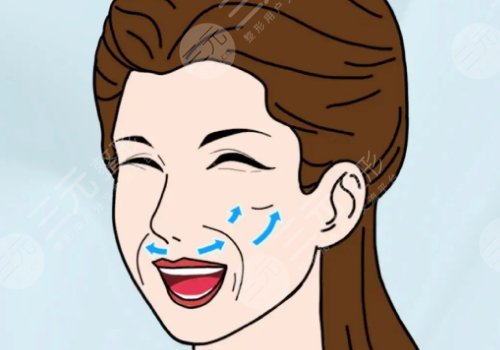北京加减美面部提升怎样？