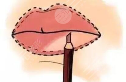 丰唇
