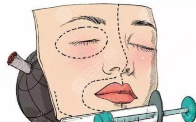 自体脂肪填充