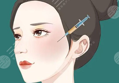 上海艺星做双眼皮怎么样？