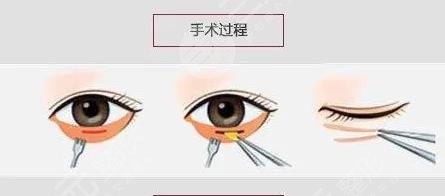 中国医学科学院整形外科医院擅长项目