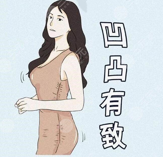 杭州时光医疗美容医院隆胸项目科普