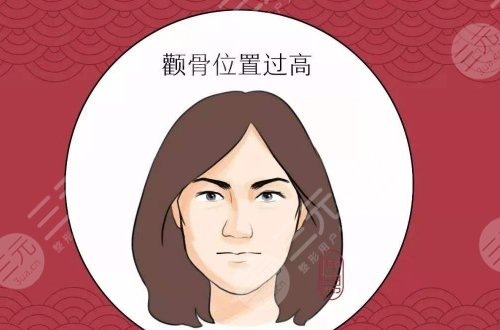 上海薇琳做颧骨内推怎么样？
