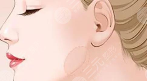 下颌角
