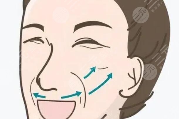 拉皮