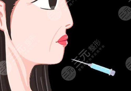 瑞蓝2号适合注射哪些部位？