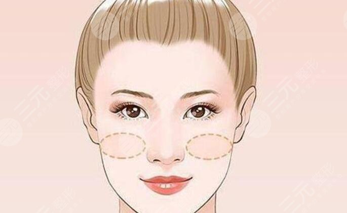 苹果肌复位