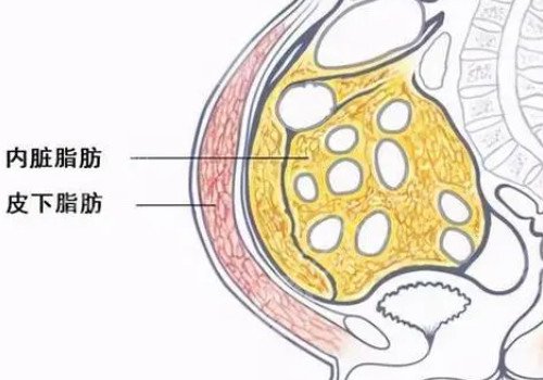德国水动力吸脂怎么样？