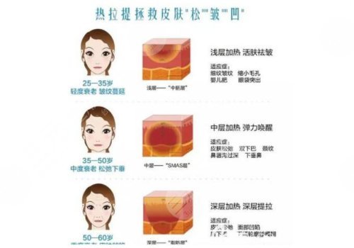 热拉提plus做一次可以维持多久