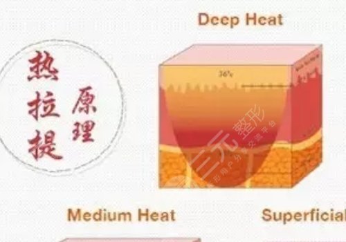 热拉提plus做一次可以维持多久