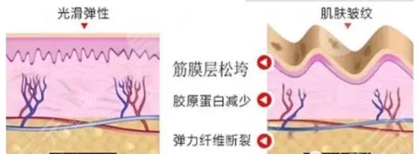 抗衰