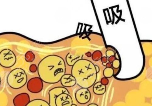 如何瘦小腿？