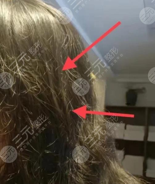 头发毛躁去理发店该怎么修复
