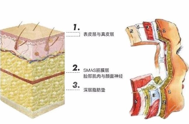 除皱