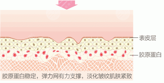 除皱