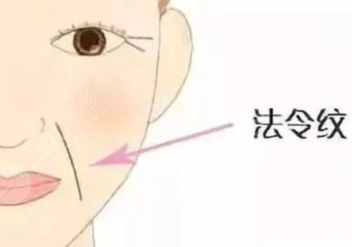 填充法令纹的具体操作方式