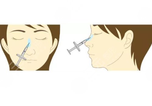 微创整形美容诊疗范围有哪些？