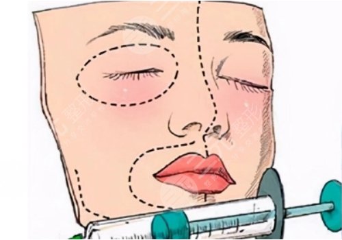 脸部轮廓医美有哪些？