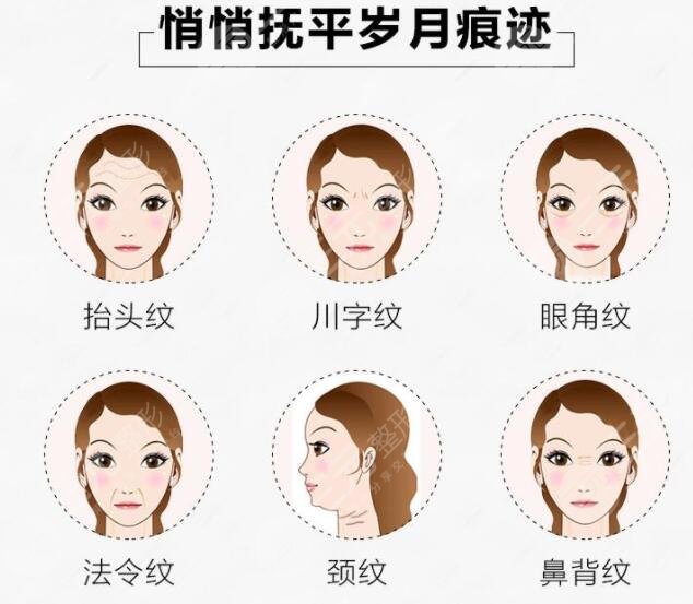 冰电波拉皮是什么?