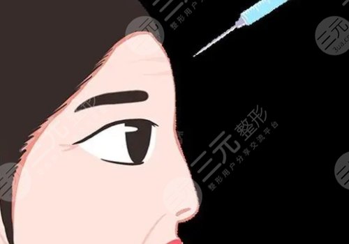 幼态脸是玻尿酸填充吗？