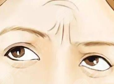 川字纹