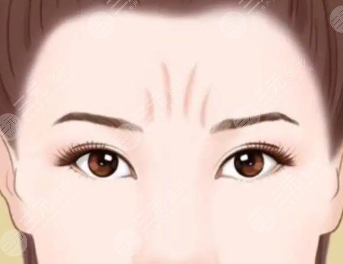 川字纹