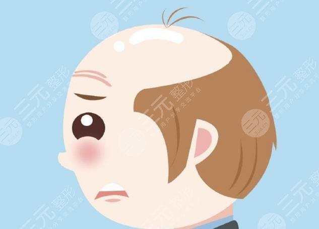 斑秃