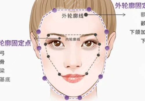 脸部轮廓整形多久能恢复？