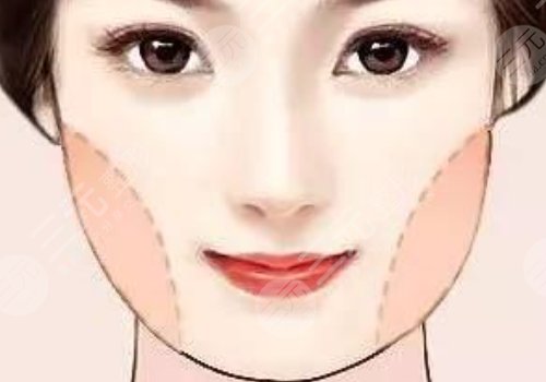 面部轮廓美容整形怎么做？