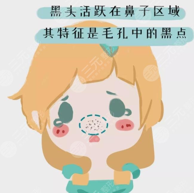 刷酸