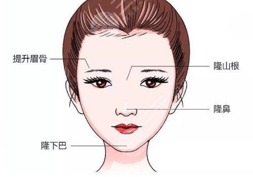 轮廓固定是什么医美项目多少钱？