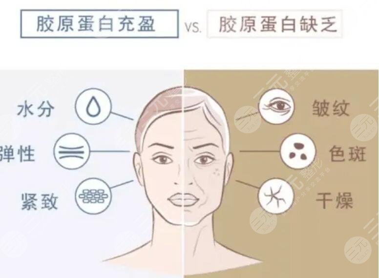 胶原蛋白