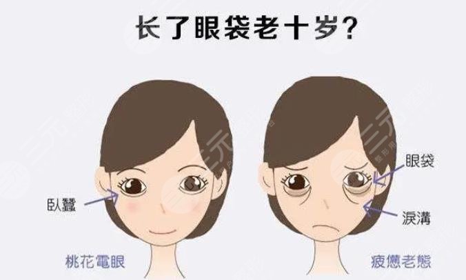 内切眼袋多久能够恢复正常
