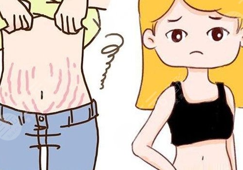 腹部拉皮和腹壁整形有哪些不一样(区别)？