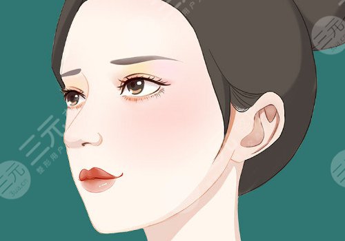 筋膜悬吊面部提升术价格是多少？