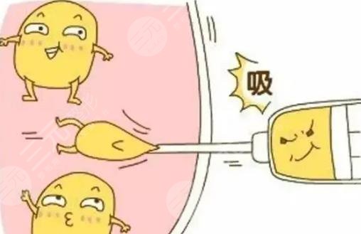 光纤溶脂