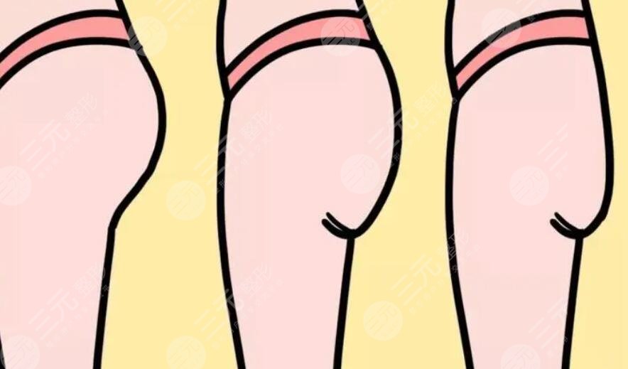 丰臀