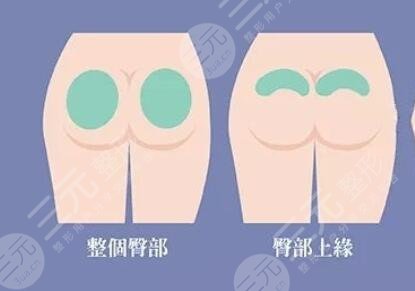 丰臀