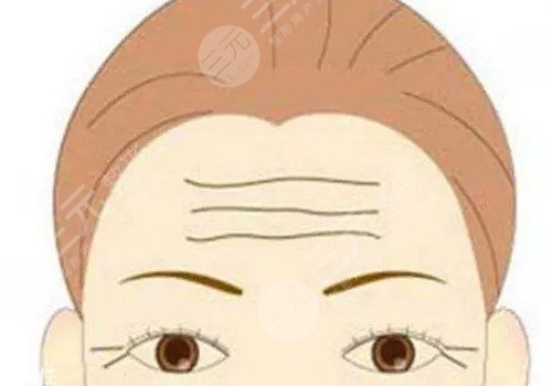 小切口提拉怎么做的？