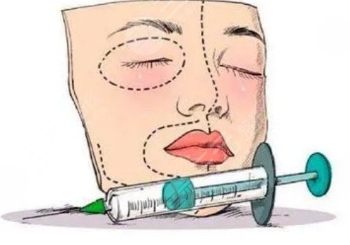 注射宝尼达后还能做假体吗？