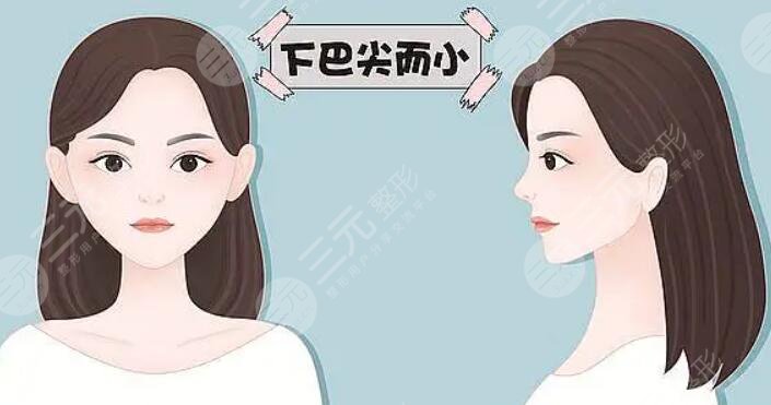 下颌缘提升