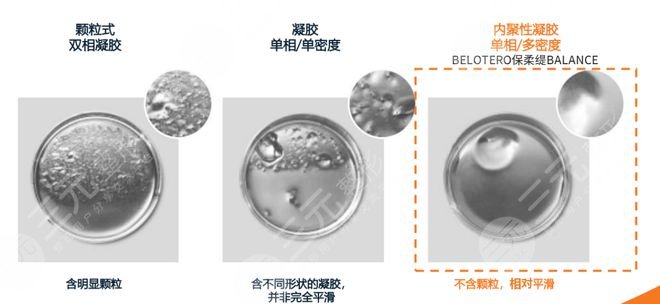 玻尿酸注射